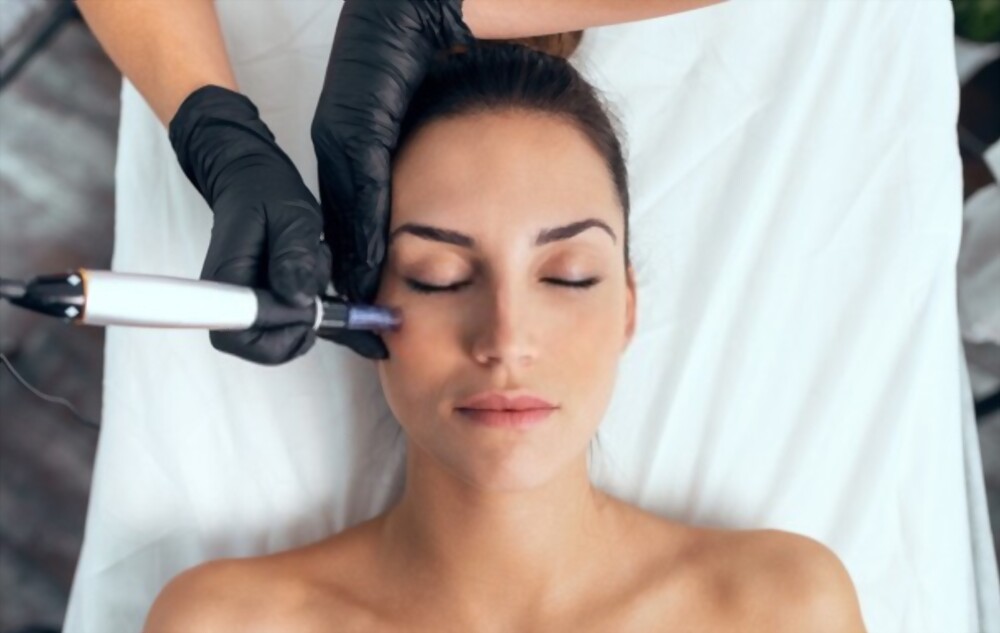 Revitalize Your Skin: The Marvels Of Microneedling