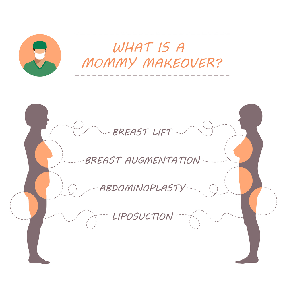 What Is A Mommy Makeover?